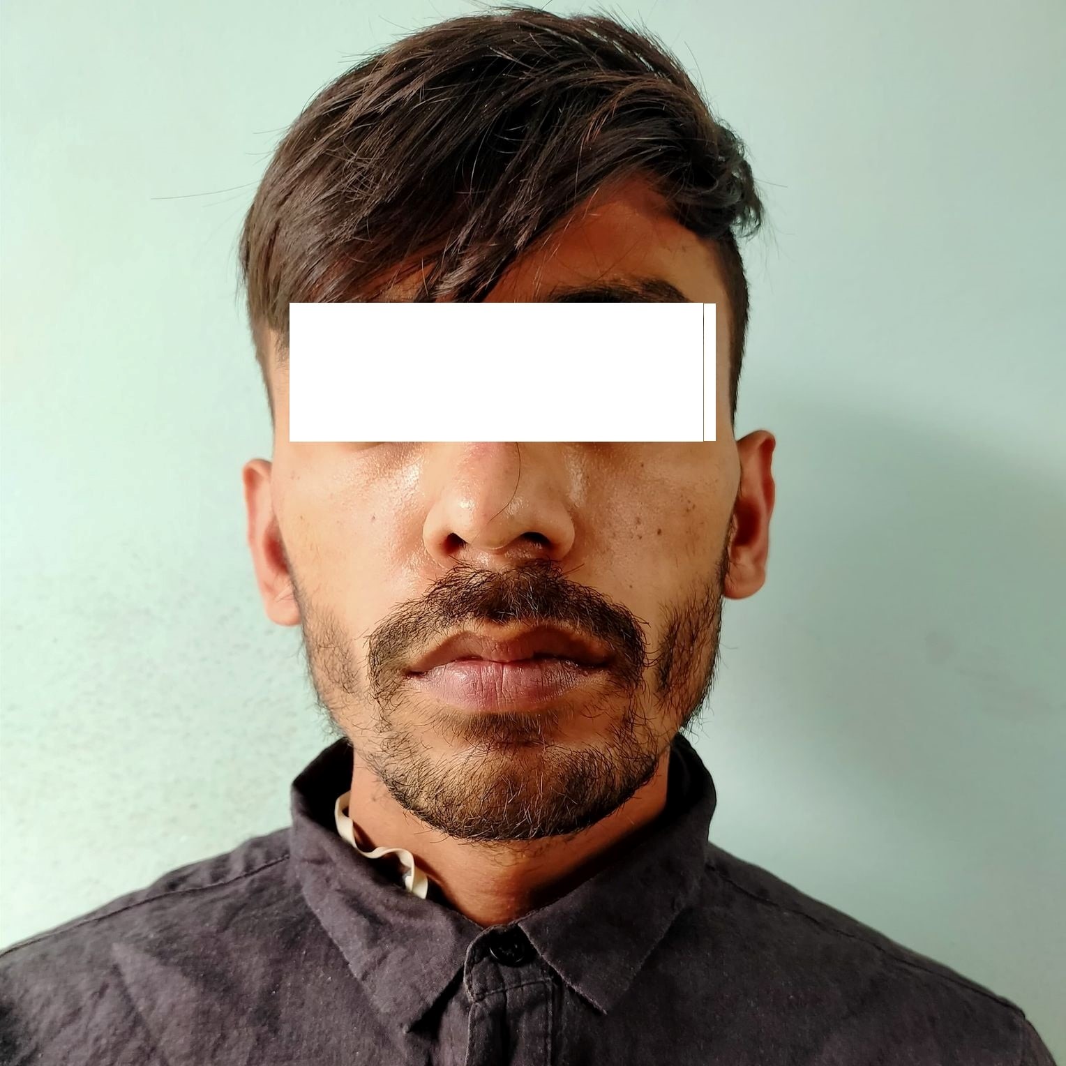 रेमडेसिवीर इंजेक्शनको कालो बजारी गर्ने व्यक्ति पक्राउ